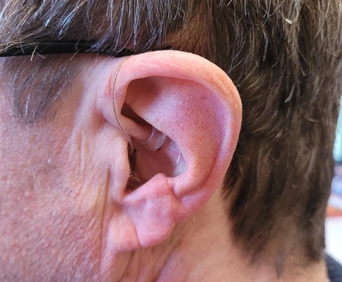 Image of adult ear with hearing aid